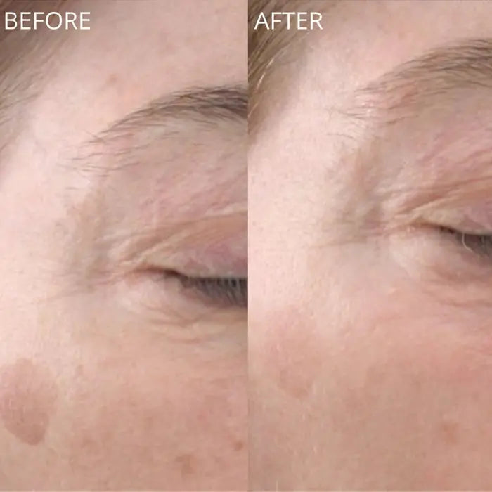 GlowBiotics Probiotic Advanced Vitamin C Brightening Anti-Aging Serum For All Skin Types 30ml GlowBiotics