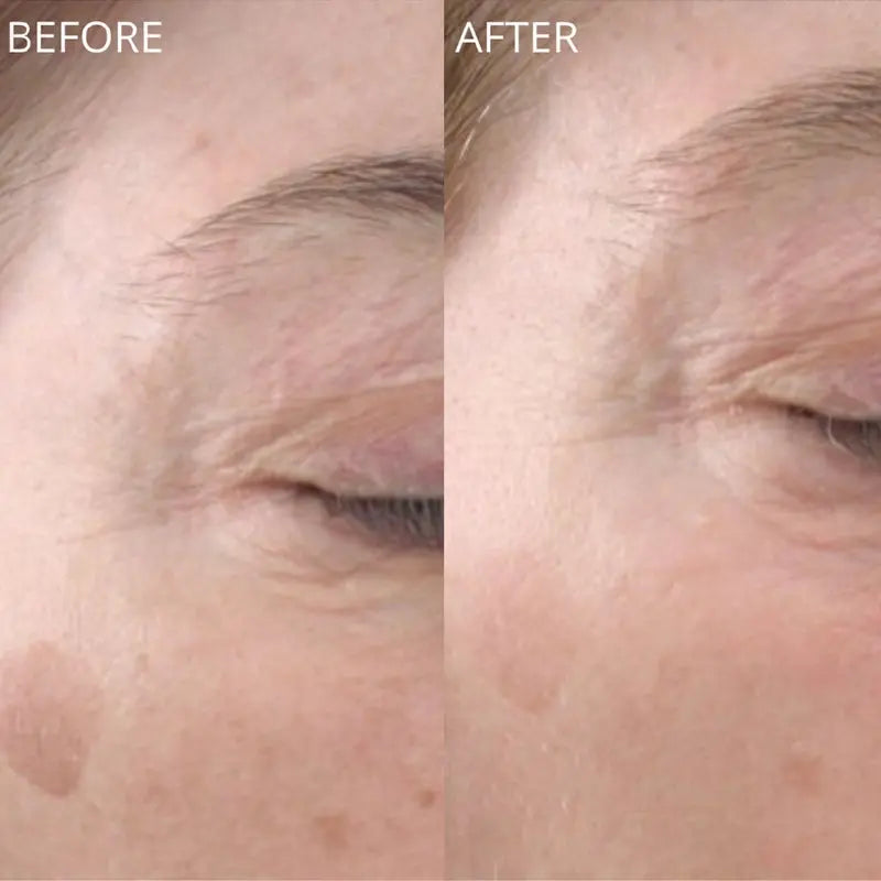 GlowBiotics Probiotic Advanced Vitamin C Brightening Anti-Aging Serum For All Skin Types 30ml GlowBiotics