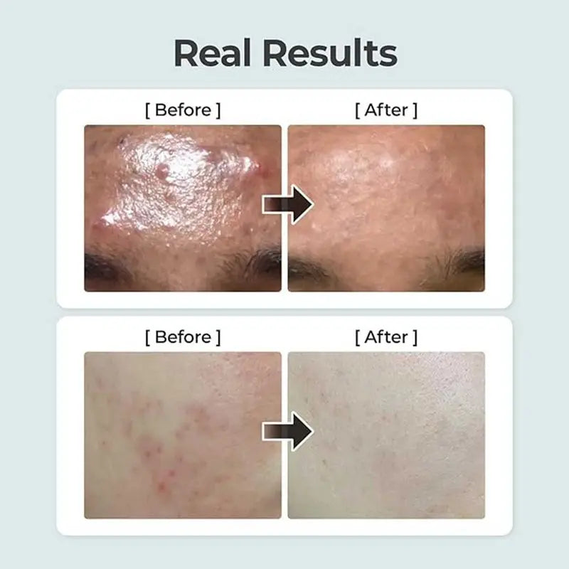 Numbuzin No 1 Pure Full Calming Herb Facial Toner For Acne Prone Skin 300ml Numbuzin