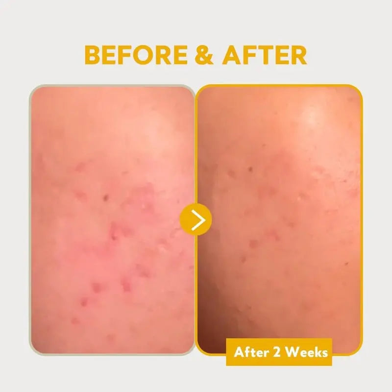 Tirtir Pure Vitamin C 24 Skin Brightening Serum For Dark Spots 30ml Tirtir