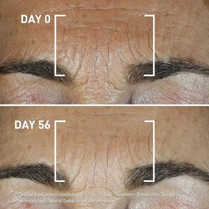 Filorga Global Repair Advanced Elixir, Antiaging Serum 30ml Filorga