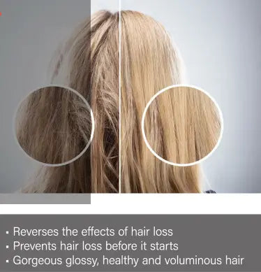 Regrow Step 1 -Cleanse & Prepare Shampoo For Women 300ml Regrow