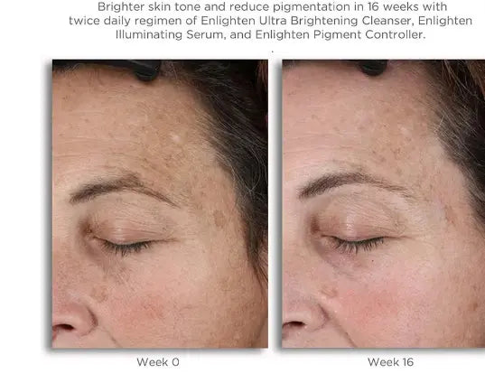 Neostrata Enlighten Pigment Controller Fluid For Dark spots and Uneven skin tone 50ml Neostrata