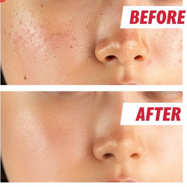 Nightingale Daily Derma Deep Facial Cleansing Pads For All Skin Types 270ml, Pack of 70’s Nightingale