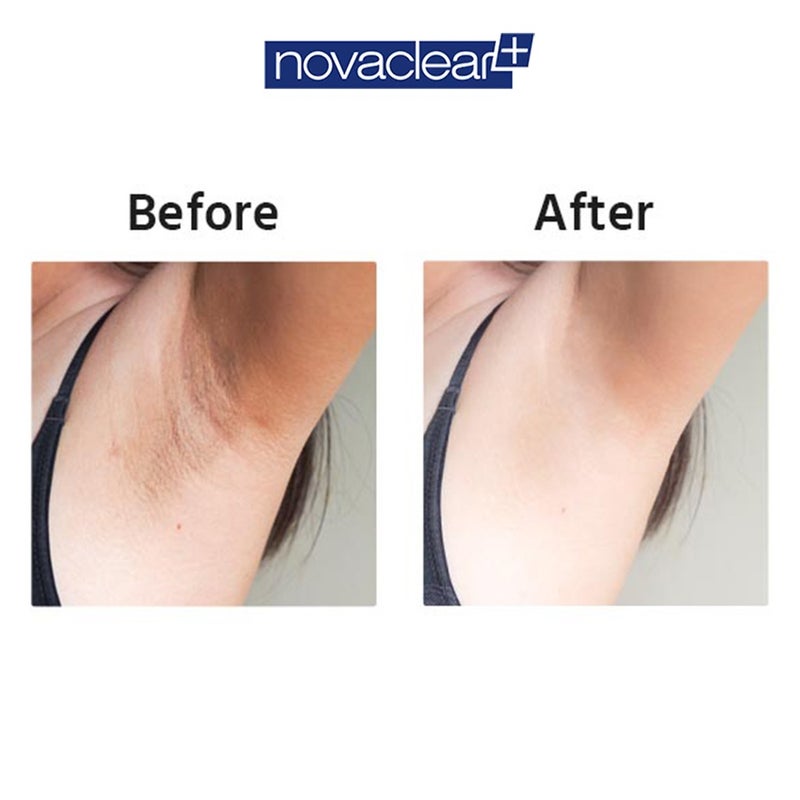 Novaclear Whitening Armpit Roll-On 50ml