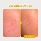 Tirtir Pure Vitamin C 24 Skin Brightening Serum For Dark Spots 30ml