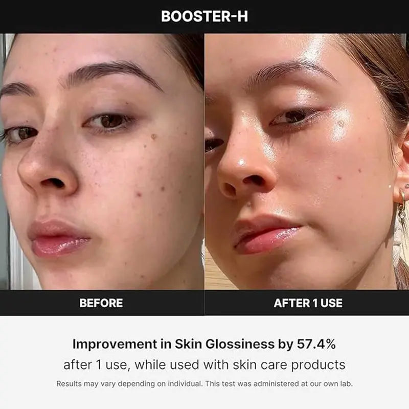 Medicube Age-R Booster H Facial Treatment Device For Deep Hydration & Glowing Skin Medicube