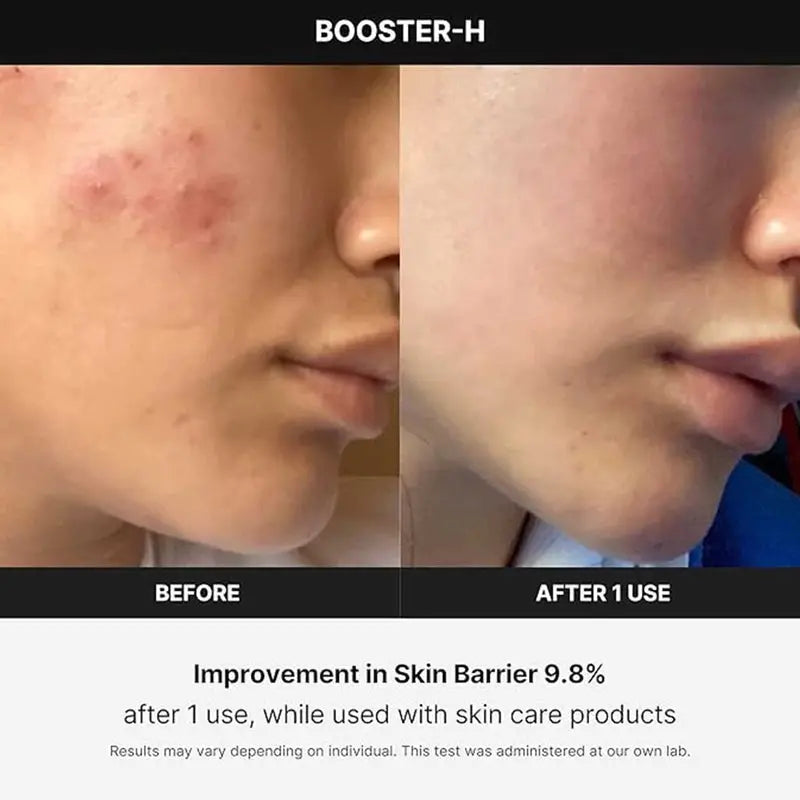 Medicube Age-R Booster H Facial Treatment Device For Deep Hydration & Glowing Skin Medicube