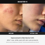 Medicube Age-R Booster H Facial Treatment Device For Deep Hydration & Glowing Skin Medicube