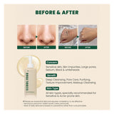 K-Secret Seoul 1988 Pine Cica 1% + Probiotics Cleansing Oil 200ml K-Secret