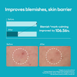 Mediheal Madecassoside Blemish Repair Serum - 40ml