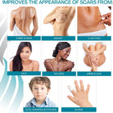 NewGel+ Advanced Silicone Scar Treatment Sheeting - 1mm Thick, Clear, 1 Pair for Areola for Post-Surgery Cosmetic Procedures