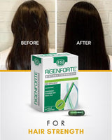 Rigenforte Hair Supplement, 30 Naturcaps- Biotinax Formula