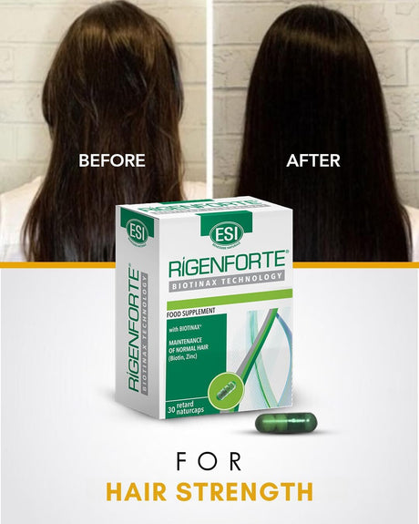 Rigenforte Hair Supplement, 30 Naturcaps- Biotinax Formula