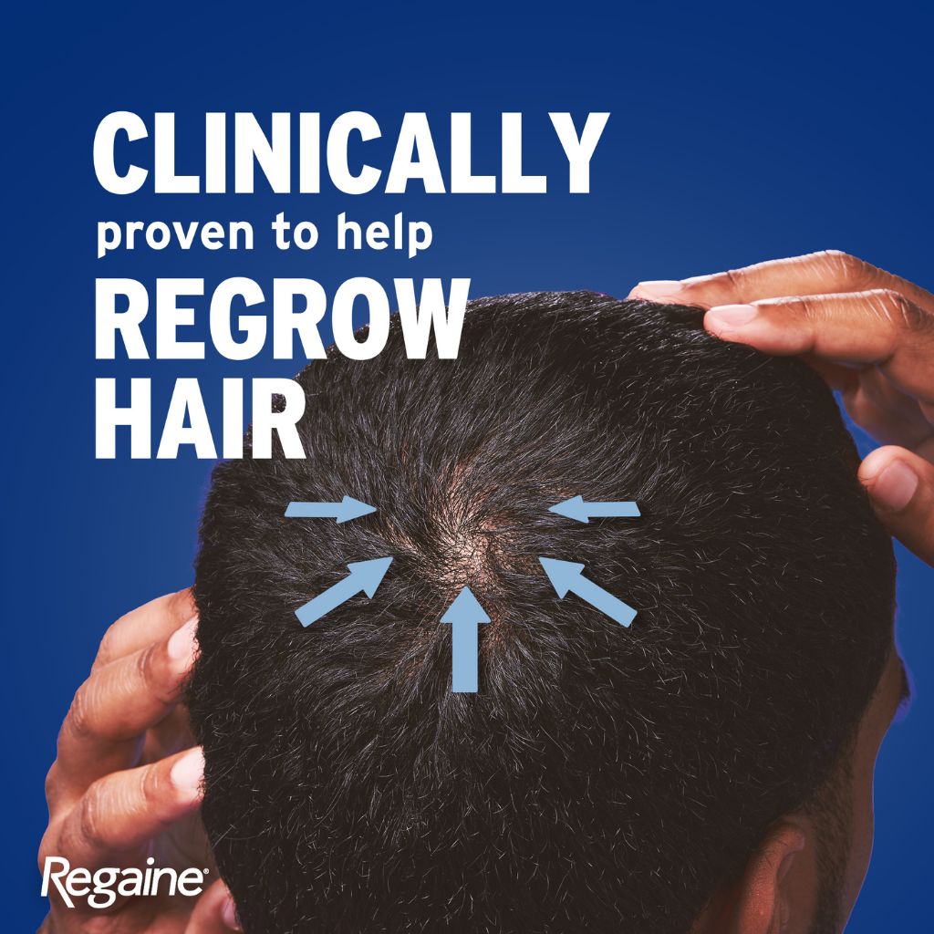 Regaine For Men 5% Hair Regrowth Foam 73ml - 3 Pack (3 Month Supply) www.plcgcc.com