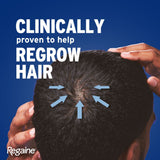 Regaine For Men 5% Hair Regrowth Foam 73ml - 3 Pack (3 Month Supply) www.plcgcc.com