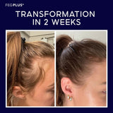 FegPlus Minoxidil Hair Spray & Beard Growth Serum - (60ml)