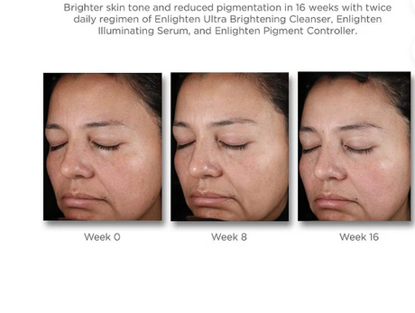Neostrata Enlighten Pigment Controller Fluid For Dark spots and Uneven skin tone 50ml