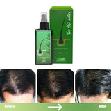 Green Wealth Neo Hair Lotion For Hair Growth 120ml